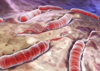 Cholera, Lassa fever kill 3,804 Nigerians