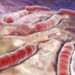 Cholera, Lassa fever kill 3,804 Nigerians