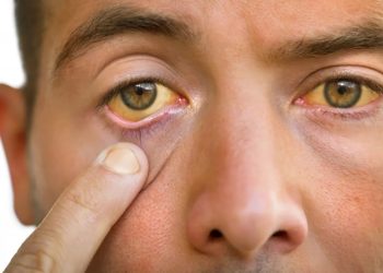 Nigeria, 15 other countries get $36.5m to eliminate trachoma